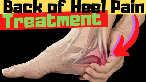 Retrocalcaneal Heel Bursitis Treatment Heel Pain Exercises And Massage