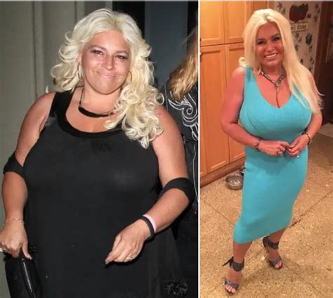 Beth Smith Dramatic Weight Loss And Cancer Battle Inspiring Story For Today