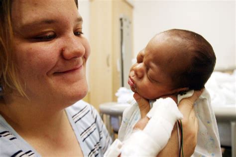 Circumcision Rate For Newborns In Us Hospitals Declines