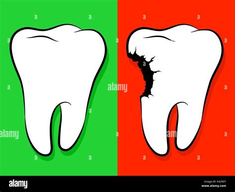 Healthy And Unhealthy Tooth Cartoon Isolated On Green For Healthy And