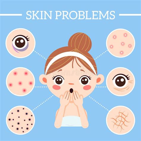 Skin Problems Infographic Ages Wrinkles Problems Blackheads And