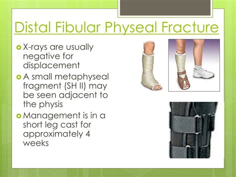 Distal Fibula Fracture Treatment Ferydisk