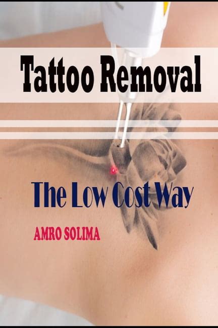 Tattoo Removal The Low Cost Way Paperback