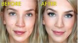 Makeup To Cover Acne Pictures