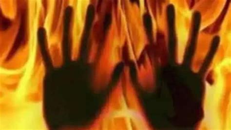 Spurned Lover Sets Self On Fire Hugs Woman In Maharashtras Aurangabad