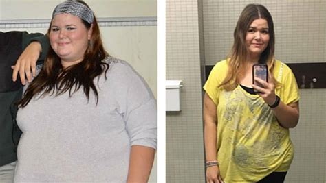Woman Sheds Almost Half Her Body Weight After Weight Loss Surgery