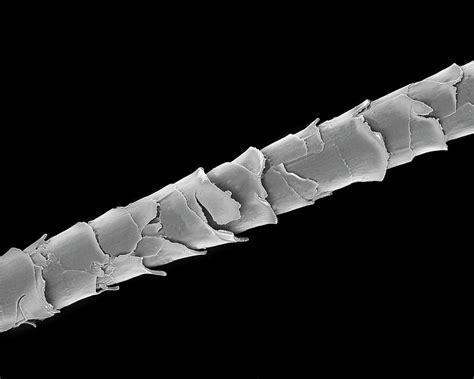 Dog Hair Shih Tzu Photograph By Dennis Kunkel Microscopyscience