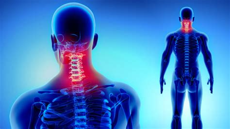 What Is Cervical Pain Causes Symptoms And Treatment