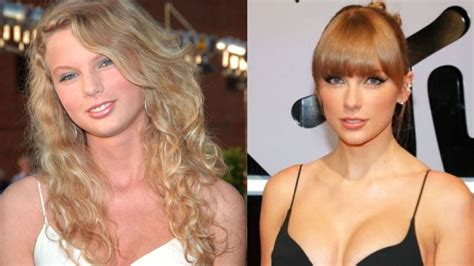 Taylor Swift S Plastic Surgery Lorry Hill S Analysis Of The Singer S Face And Body Did She