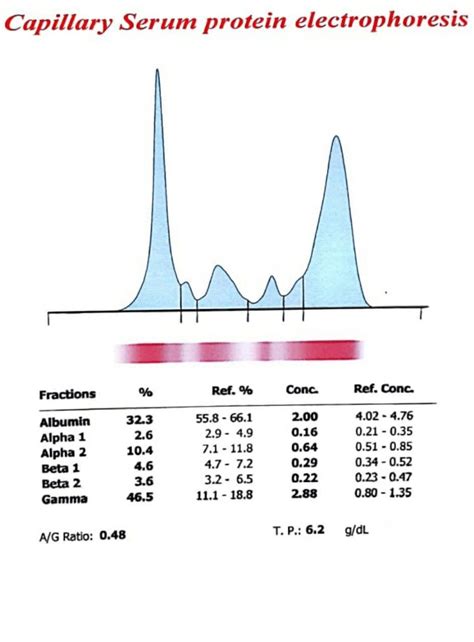 Capillary Serum Protein Electrophoresis Abbreviations Ulcerative