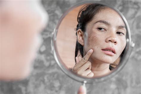3 Step Night Time Skin Care Regime To Get Rid Of Dark Spots On Your