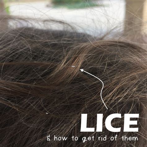 Easter bunny got lots an lots of easter eggs but they are'nyt 4 u. You've Got Lice - Here's How to Get Rid of Lice, Without ...