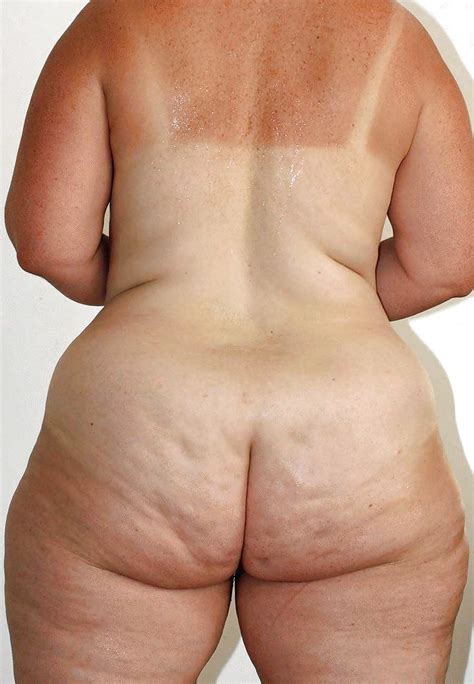 White Cellulite Big Hip Ass 46 Pics Xhamster