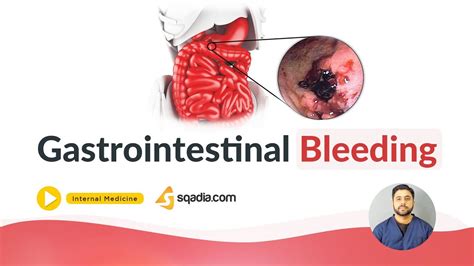 Gastrointestinal Bleeding Medicine Online Education Medical