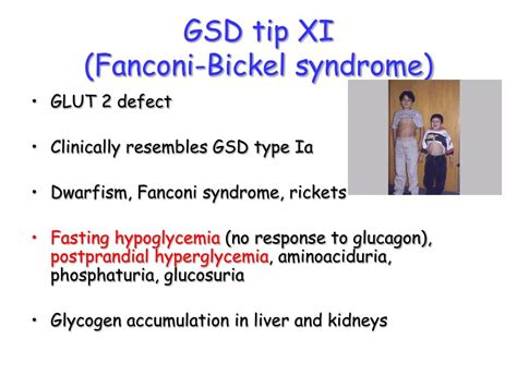Glucagon was originally thought to be a contaminant that caused hyperglycemia found in pancreatic extracts in studies from 1923. Use Of Glucagon And Ketogenic Hypoglycemia - Hypoglycemia in new born / Glucagon for therapeutic ...