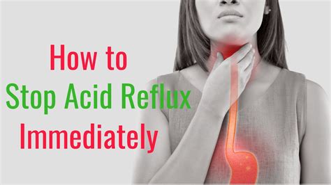 What Can Stop Acid Reflux Immediately