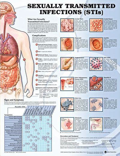 Sexually Transmitted Infections Chart 20x26 Top Nursing Schools Nursing Notes Nursing Tips