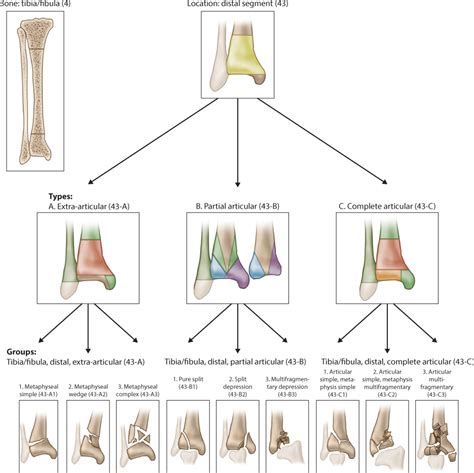 Aoota Classification Of Distal Tibial Fractures Adapt