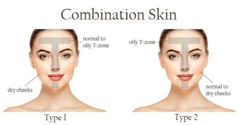 Combination Skin ⋆