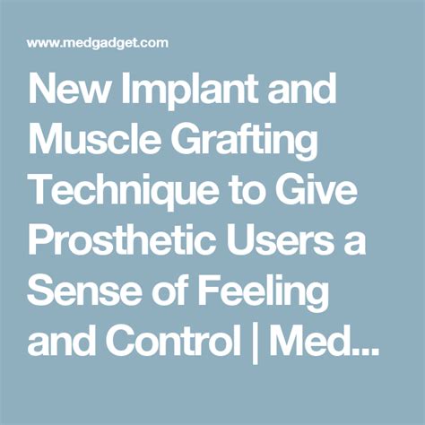 New Implant And Muscle Grafting Technique To Give Prosthetic Users A