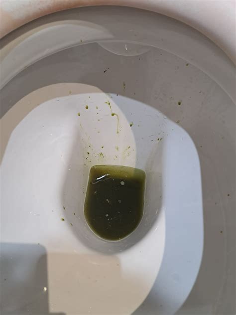 Green Diarrhea Rmedical