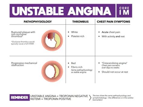 What Is Unstable Angina
