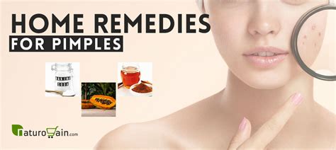 6 Home Remedies For Pimples Get Rid Of Acne Quickly