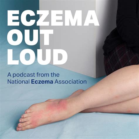 Itch Fighting Tips From A Dermatologist With Eczema Dr Mamta Jhaveri