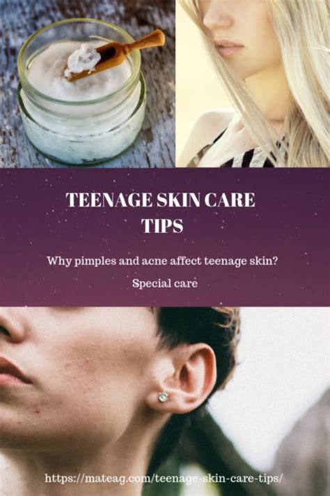 Teenage Skin Care Tips Skin Care Tips Skin Care
