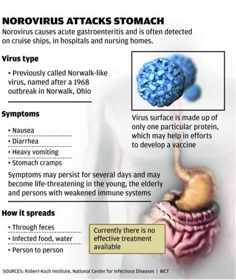 Stomach Virus Spreads Around St Louis Health