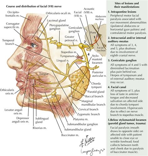 Cranial Nerve Vii Neupsy Key