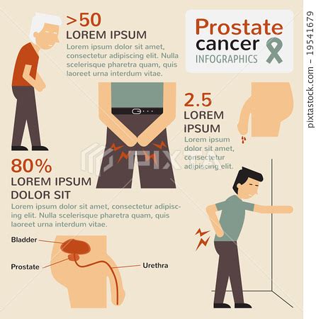 Prostate Cancer Infographics Stock Illustration Pixta