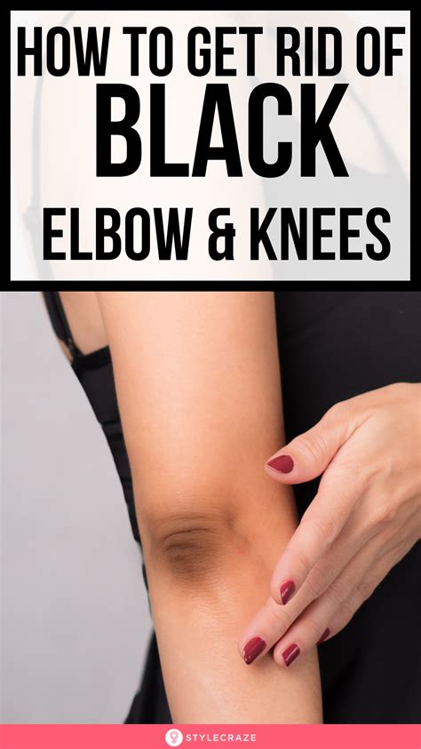 14 Home Remedies To Get Rid Of Black Knees And Elbow Summer Skin Care