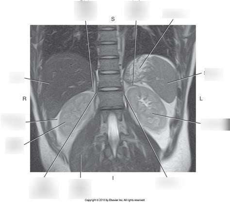 Mri Coronal Abdomen Diagram Quizlet