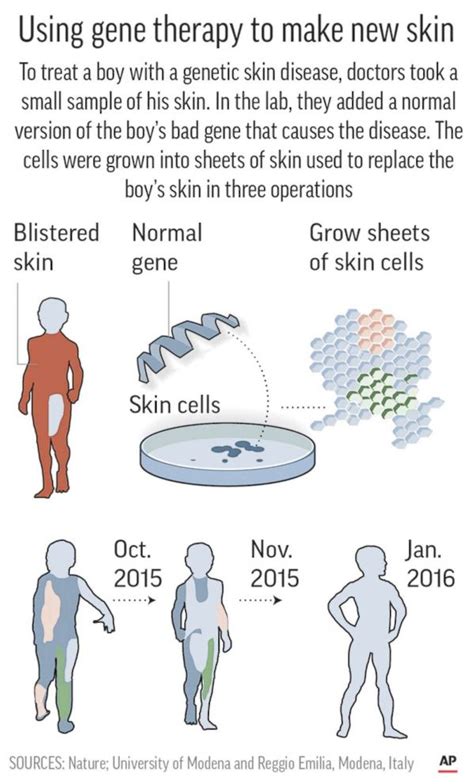 Doctors Replace Boys Skin Using Breakthrough Gene Therapy Stem Cells