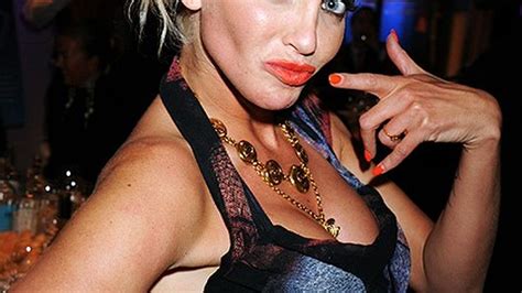 Where Will The Terrifying Evolution Of Sarah Harding S Face End