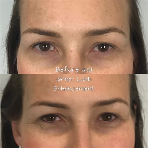 Cosmetic Tattooing - OLLI SKIN