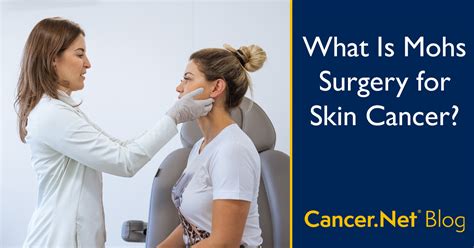 Mohs Surgery For Skin Cancer What To Know And What To Expect Cancernet