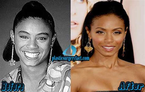 Jada Pinkett Smith Plastic Surgery Before And After Photos Plastic
