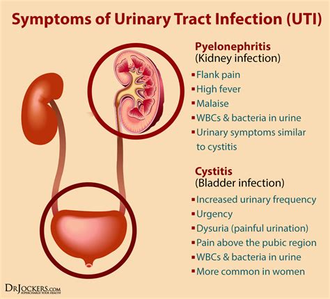 Phases To Support Urinary Health Naturally DrJockers Com