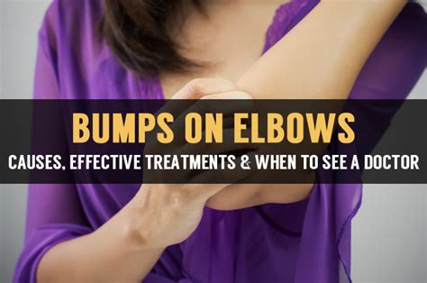 Itchy Bumps On Elbows Causes And Natural Treatment