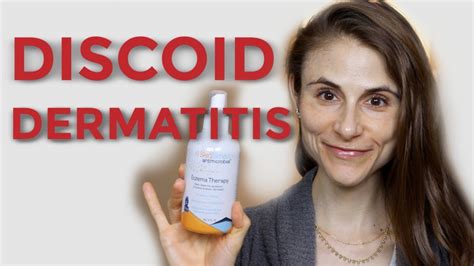 Discoid Nummular Dermatitis Tips From A Dermatologist Dr Dray Youtube
