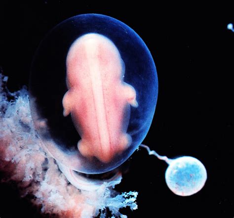 Discovering Something New Ongoing Learning Human Embryo At 6 Weeks