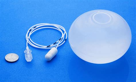 Temporary Swallowable Gastric Balloon Helps Obese Lose 15kg On Average