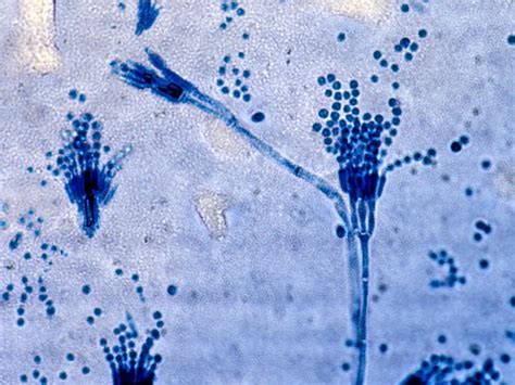 Penicillium Under Microscope 40x Micropedia