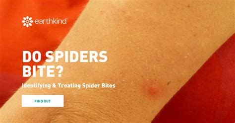 Common House Spider Bites Identification And How To Treat