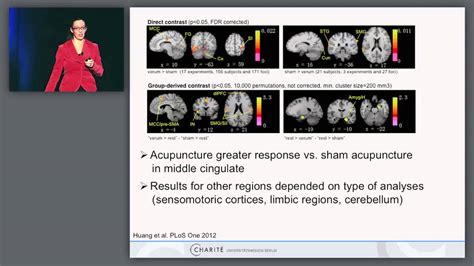 Neuroimaging And Stimulation Studies Youtube