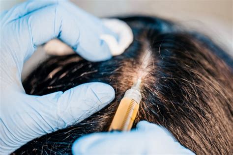 6 Cutting Edge Hair Growth Treatments For 2020 Nutrafol