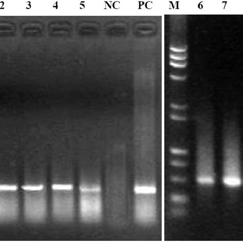 Southern Blotting Analyses Of Genomic Dna Samples Extracted From The