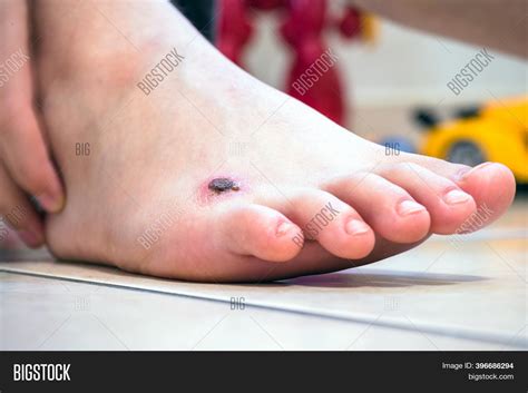 Childs Foot Boy Image And Photo Free Trial Bigstock